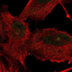 TTC21A Antibody, Novus Biologicals 0.1mL; Unlabeled:Antibodies, Polyclonal